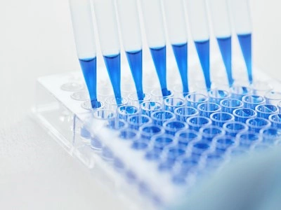 SSI Antibodies
T. +45 3268 3730
@. ssi-antibodies@ssi.dk