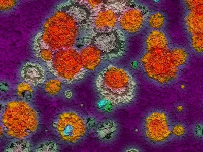 Bacteria, Parasites &amp; Fungi



T. +45 3268 8600
@. afdmi@ssi.dk