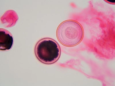 Bacteria, Parasites & Fungi
T. +45 3268 8600
@. afdmi@ssi.dk