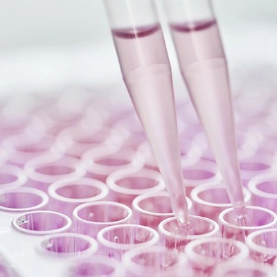 Statens Serum Institut has more than 100 years of experience in research, development and manufacturing of biologics.